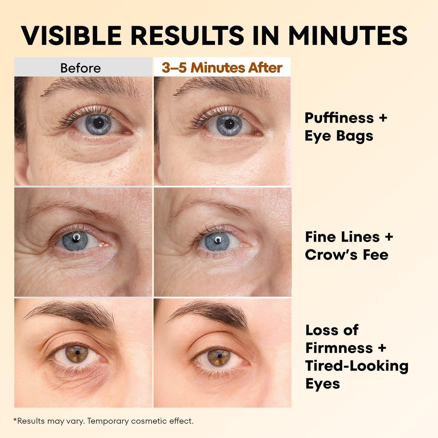 RONKIE Instant Firm Eye Tightener: Upgraded Formula for Women Helps Reduce Eye Bags Puffiness and Wrinkles in 3-5 Minutes When Time Matters 1.34 oz Beauty and Personal Care RONKIE