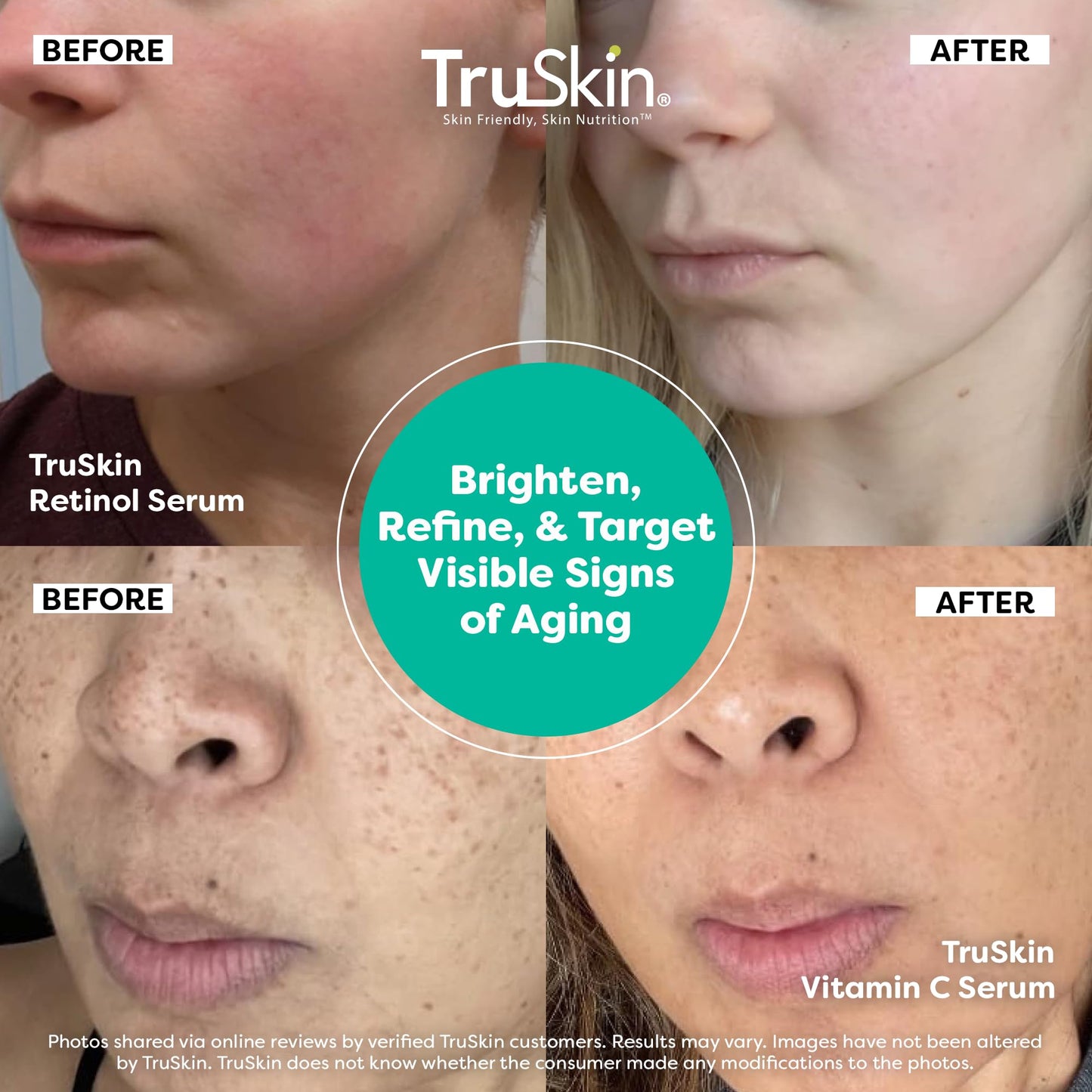 TruSkin Face Serum Duo - Vitamin C Serum & Retinol Serum for Face - AM & PM Anti Aging Skincare Routine - Brightening & Smoothing Facial Serums, 1 fl