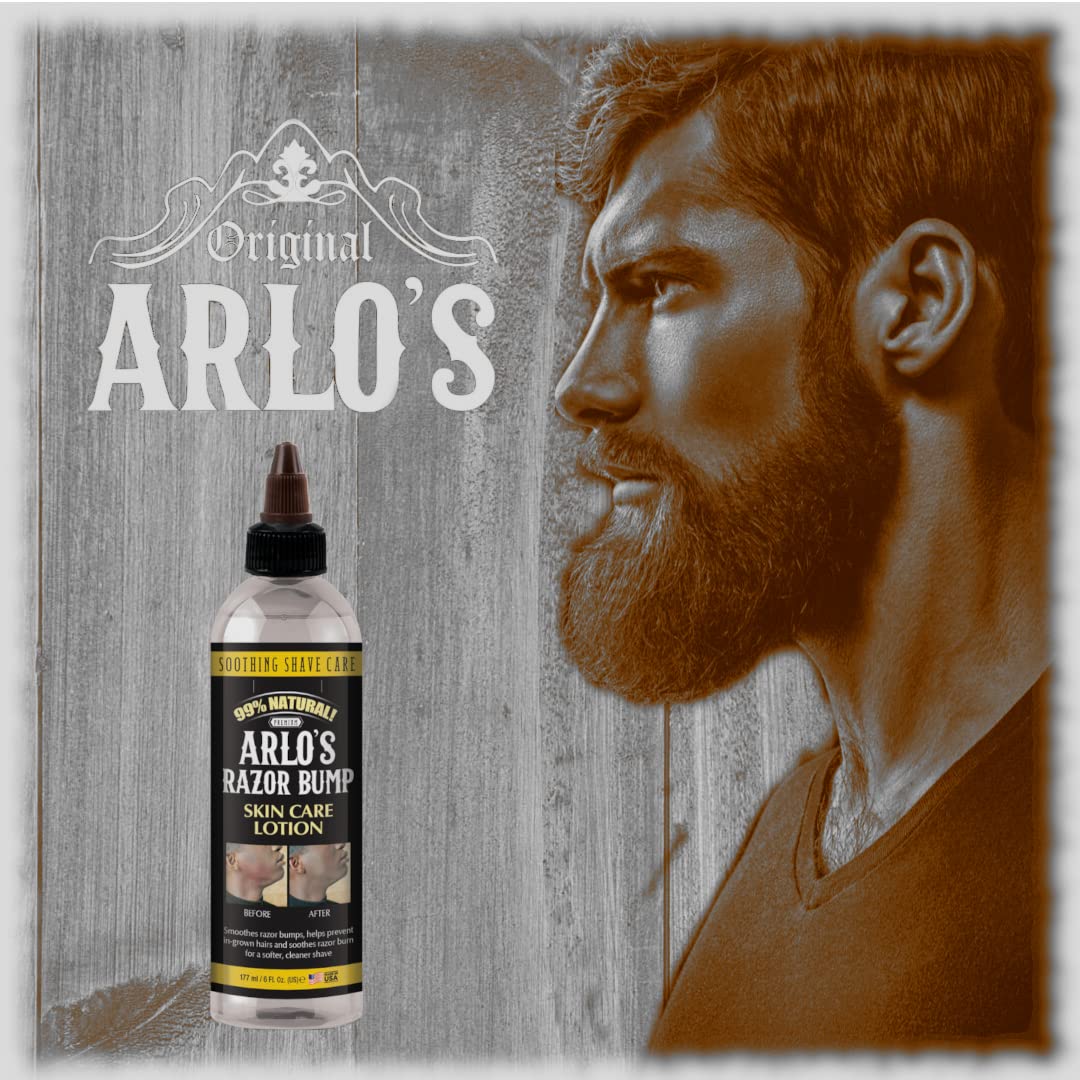 Arlo's Razor Bump Skin Care Lotion 6 oz.
