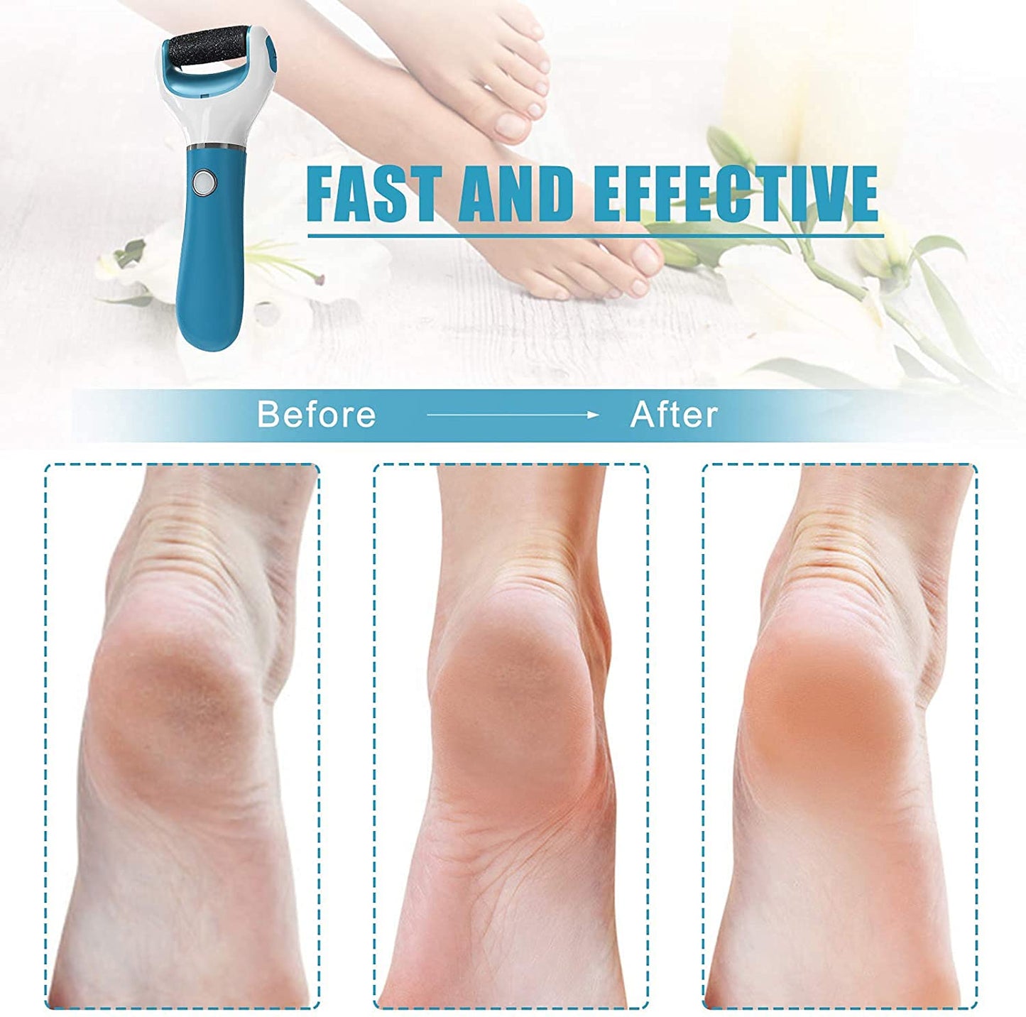 Electric Foot File Callus Remover Professional, 2-Speed Rechargeable Pedicure Tool for Remove Calluses, Dry, Hard, Dead, Cracked Skin, Includes 2
