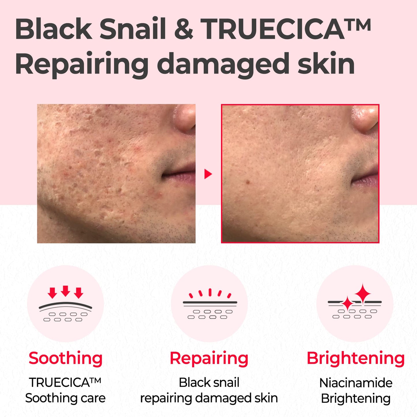 SOME BY MI Snail Truecica Miracle Repair Toner - 4.6Oz, 135ml - Made from Snail Mucin for Sensitive Skin - Daily Repair Face Toner with Skin Texture
