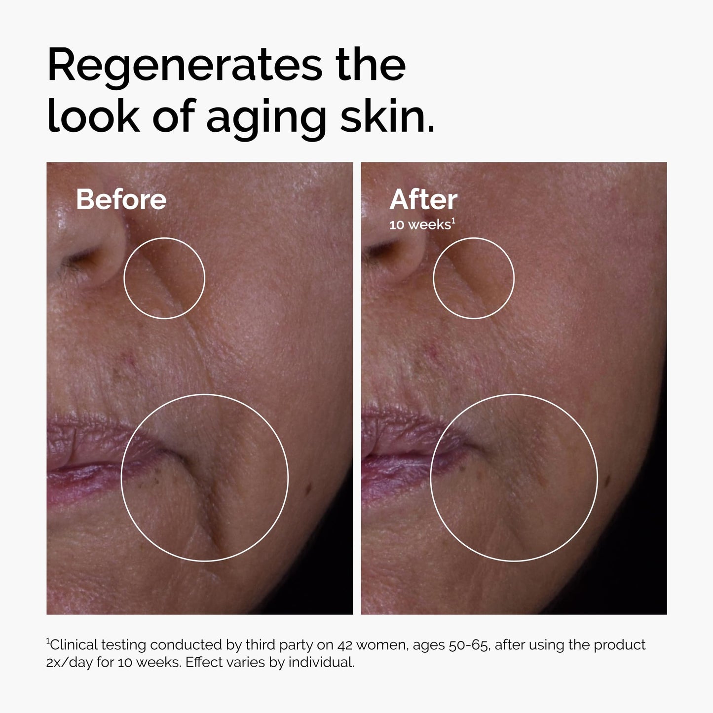 The Ordinary GF 15% Solution, Anti-Aging Formula for Visible Skin & Wrinkle Repair, 1 Fl Oz Beauty and Personal Care The Ordinary