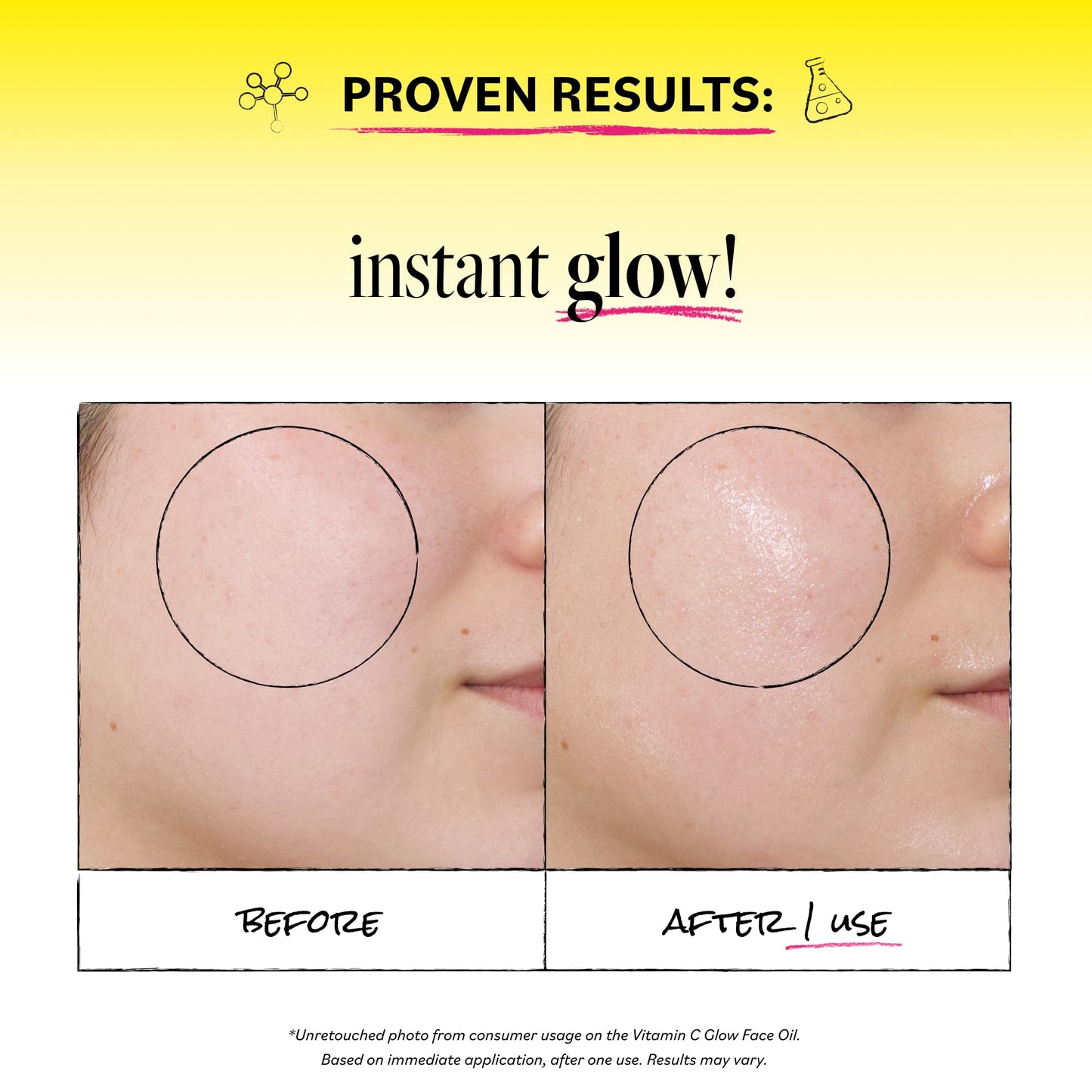 Derma E Vitamin C Glow Face Oil, 1 Fl Oz, Nourishes, Brightens and Illuminates for Radiant Skin, Moisturizing Vitamin C Oil with Turmeric