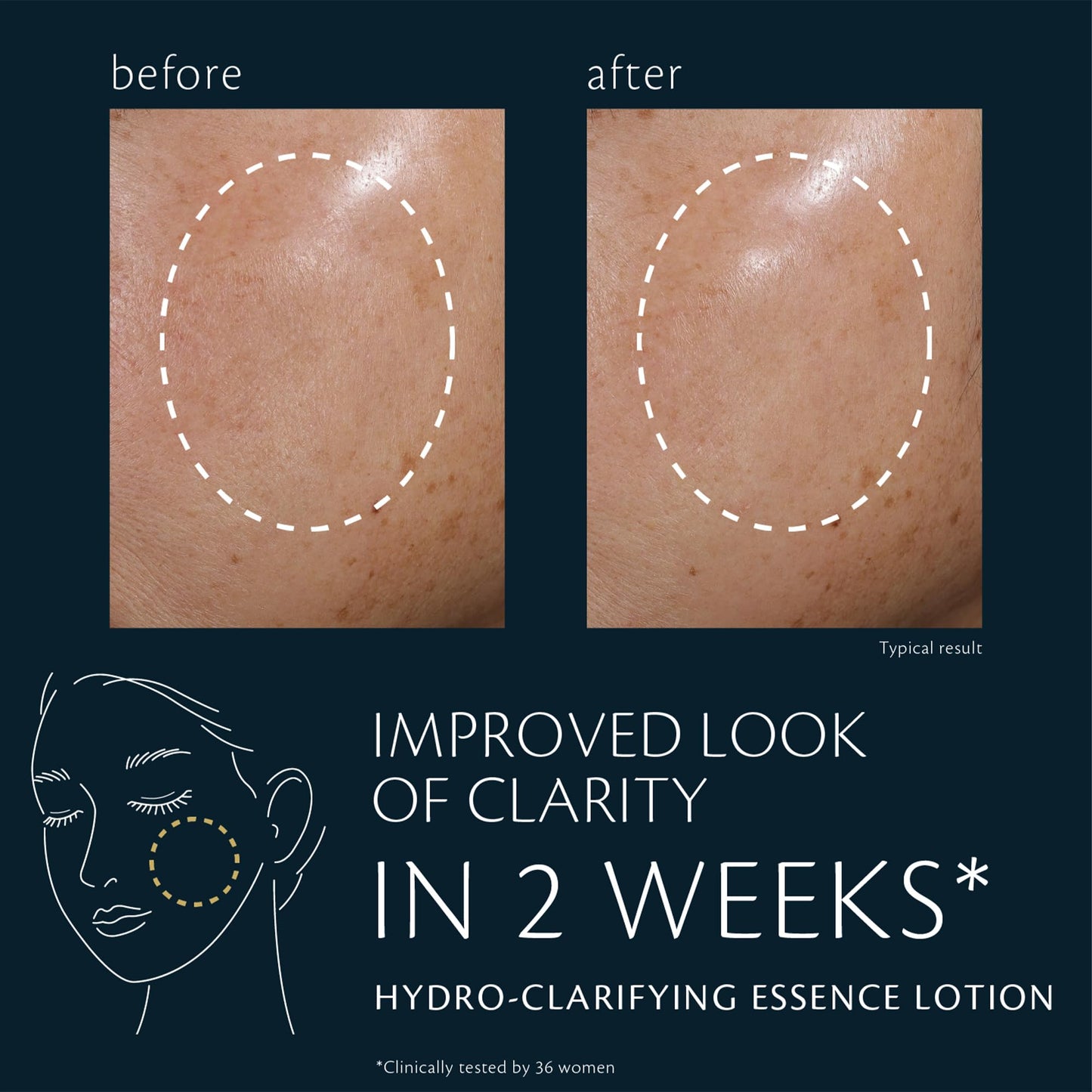 Hydro-Clarifying Essence Lotion
