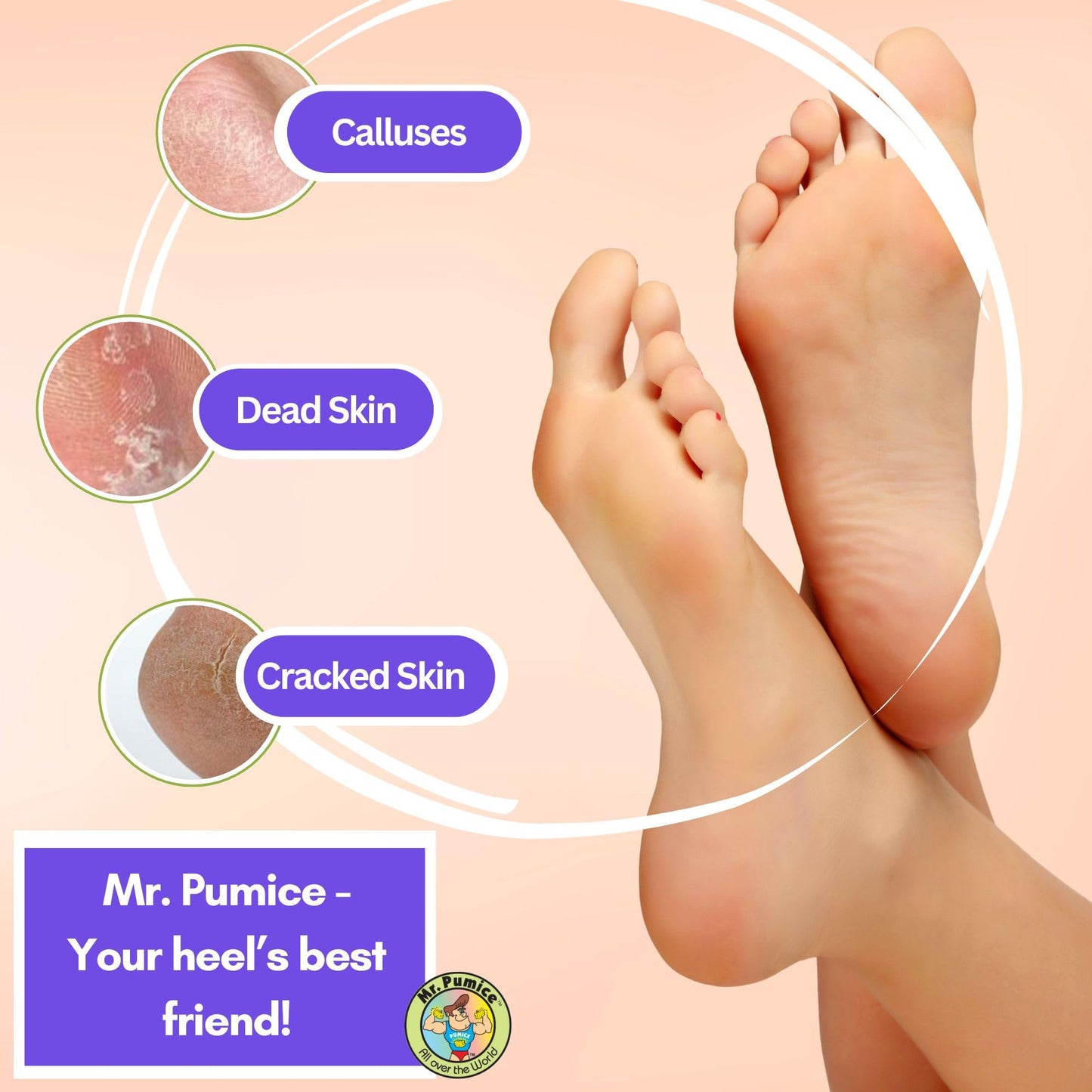 Mr. Pumice Ultimate PUMI Bar 2-in-1 Dual Grit (Medium + Coarse) Callus Remover, Pedicure Stone & Ped File Scrubber for Smooth Feet and Heels (4 Pack) Beauty and Personal Care Mr. Pumice