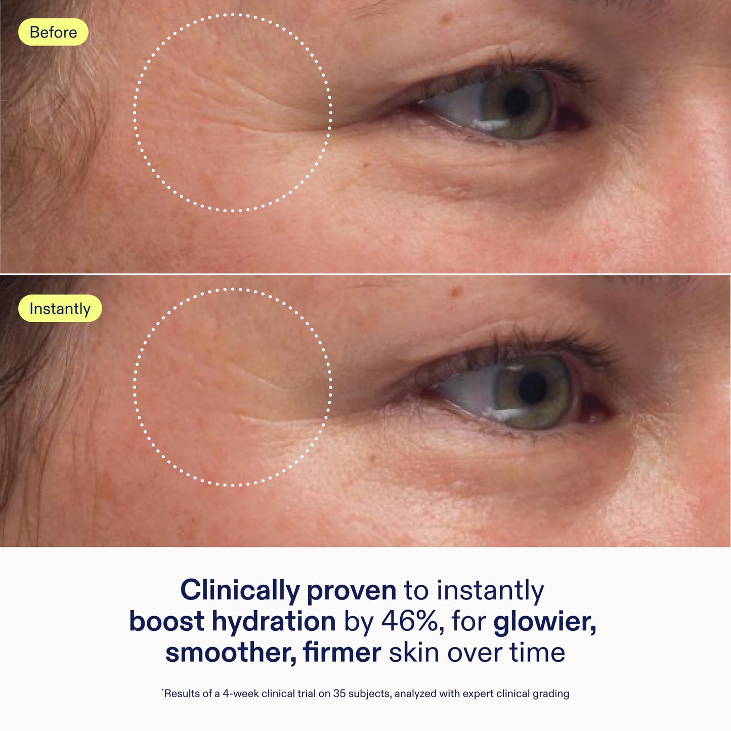 Skinfix Triple Lipid-Peptide Cream Mini 0.5oz – Rich Moisturizer for Dry, Sensitive Skin, Hydrating, Non-Comedogenic, Vegan & Fragrance-Free