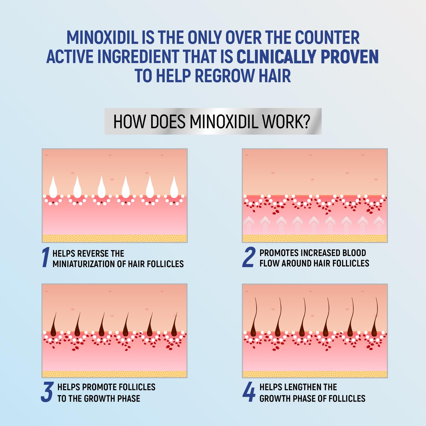 Minoxidil 5% Topical Aerosol Foam, Hair Regrowth 4 Months Treatment for Men, 2.11 oz (4 Pack) Beauty and Personal Care TARO
