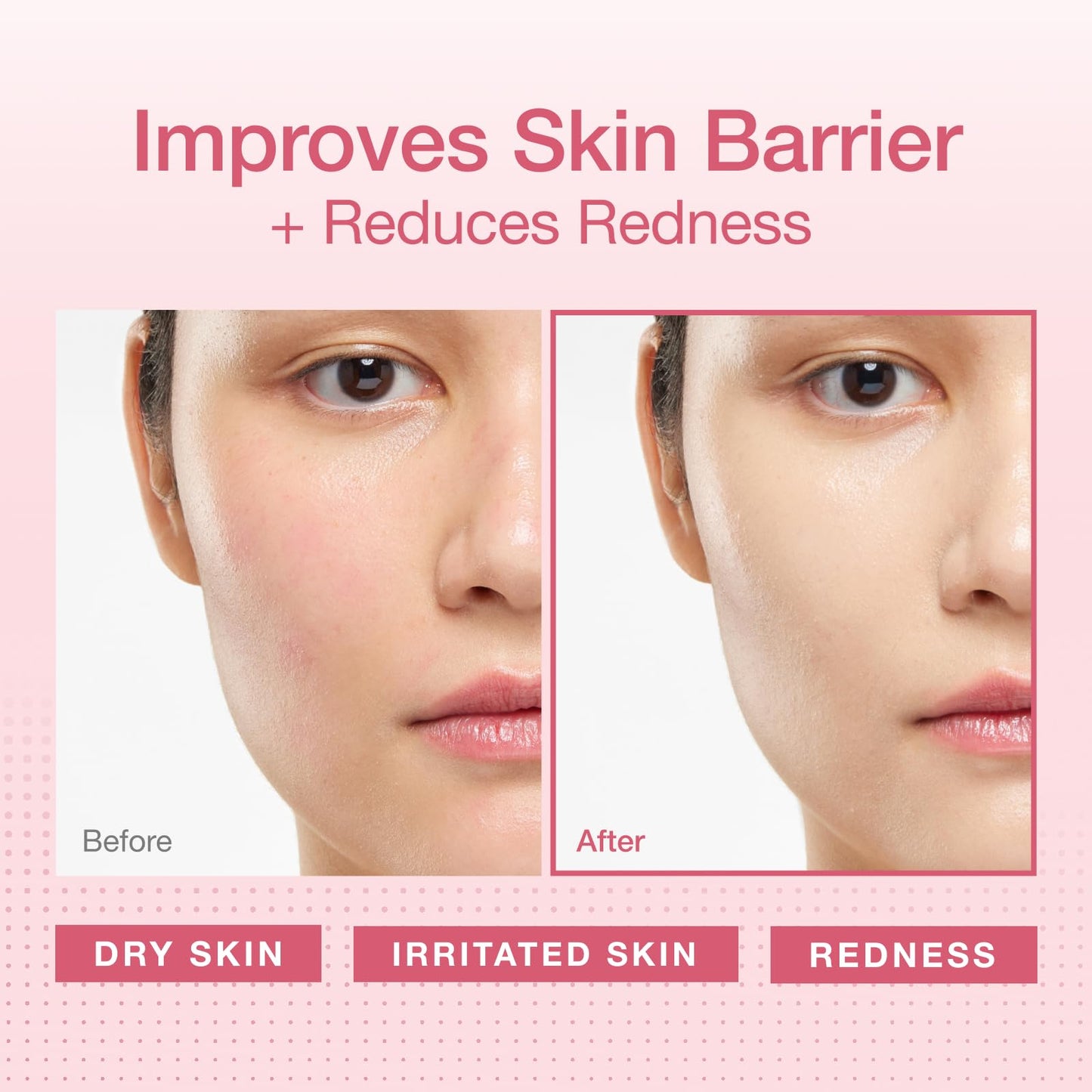Physiogel Redness Reducing Cream - Ceramide Moisturizer for Dry, Sensitive & Redness-Prone Skin, Repairs Skin Barrier, Dermatologist-Tested