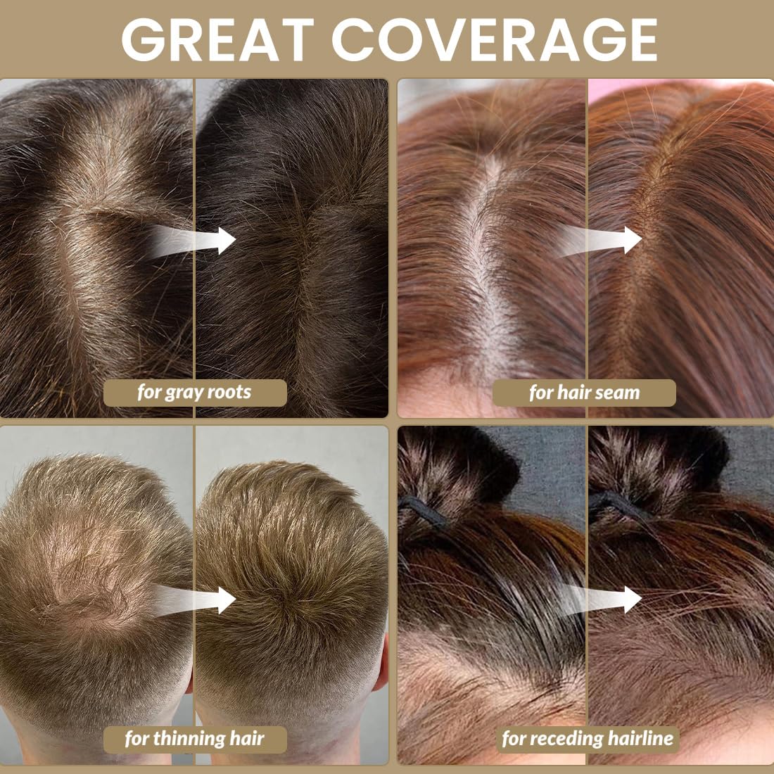 VOLLUCK Root Touch up Powder, Instant Hairline Powder for Thinning Areas and Gray Hair Coverage, Natural and Non-greasy Root Cover up for Women Beauty and Personal Care VOLLUCK