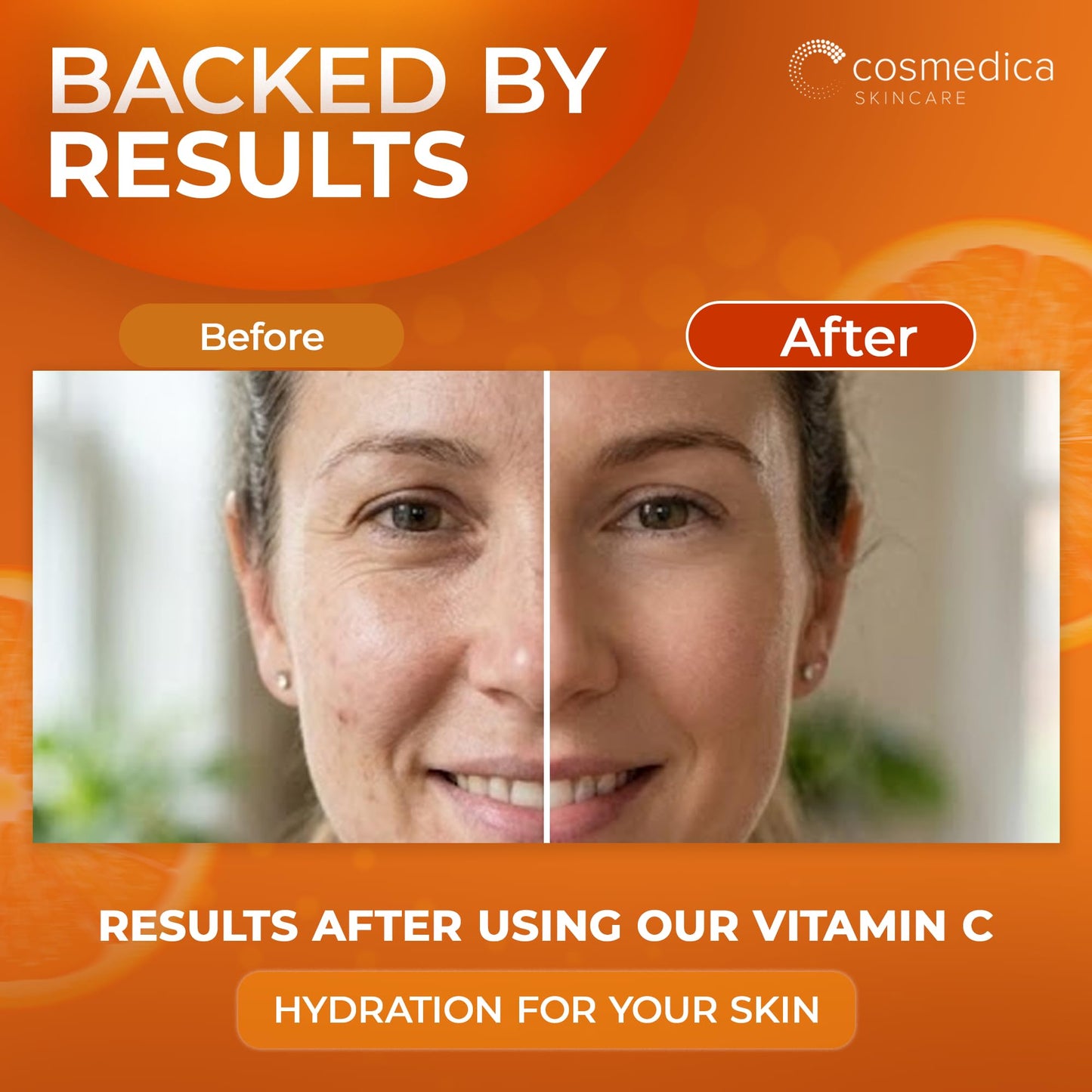 Cosmedica Vitamin C Serum for Face with Hyaluronic Acid & Vitamin E - Brightening Anti-Aging Serum for Dark Spots, Fine Lines & Wrinkles, Lightweight