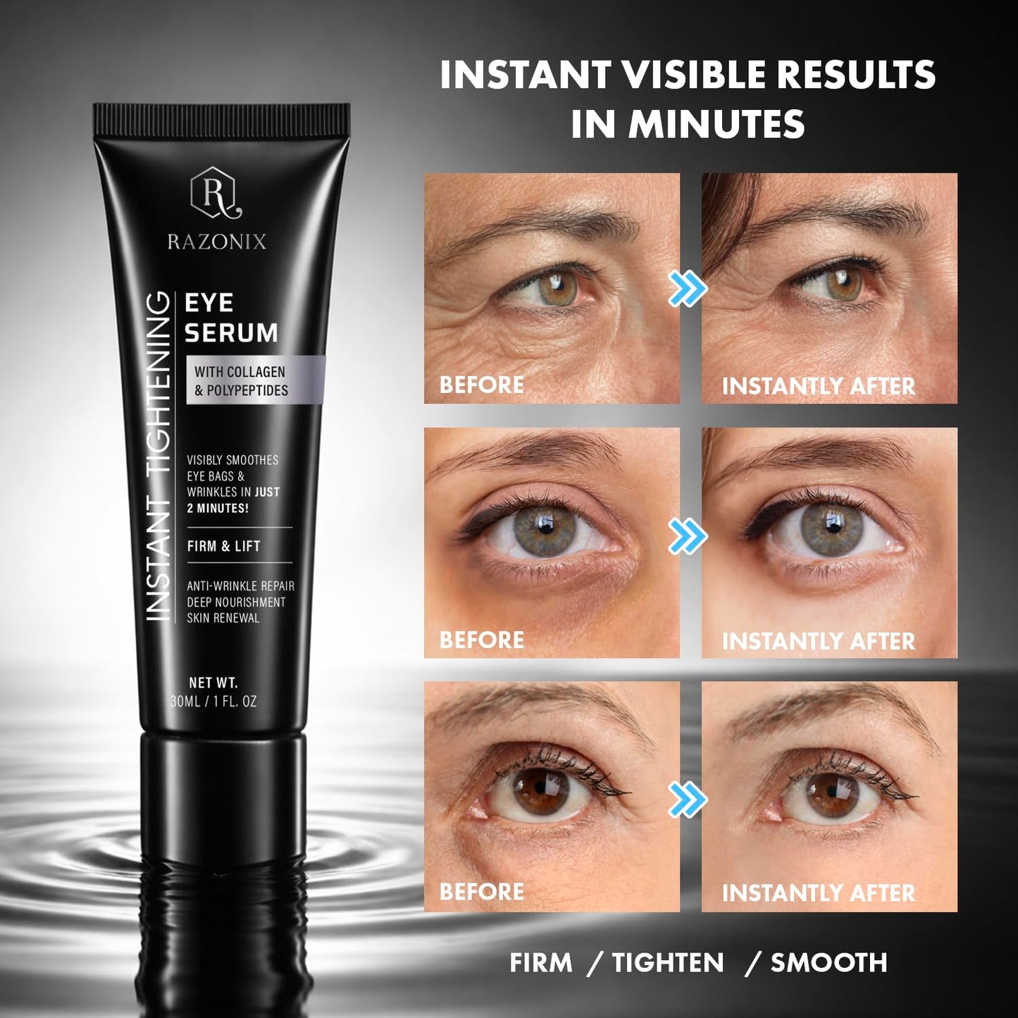 RAZONIX Instant Eye Tightening and Lifting Serum for Under Eye Bags, Puffiness, Dark Circles, and Hooded, Droopy Eyelids, with Caffeine and Hyaluronic Beauty and Personal Care RAZONIX