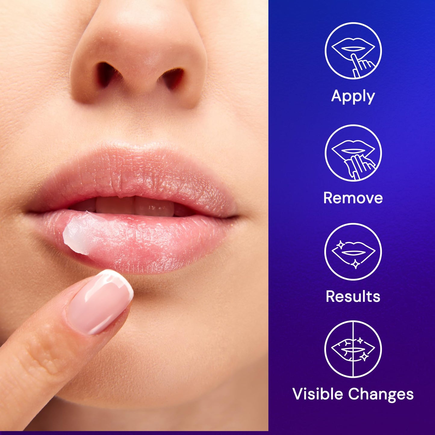 SNOW Overnight Lip Treatment - Moisturizing Lip Balm with Shea Butter & Vitamin E - Lip Treatment for Dry, Cracked Lips - Sulfate-Free Lip Treatment
