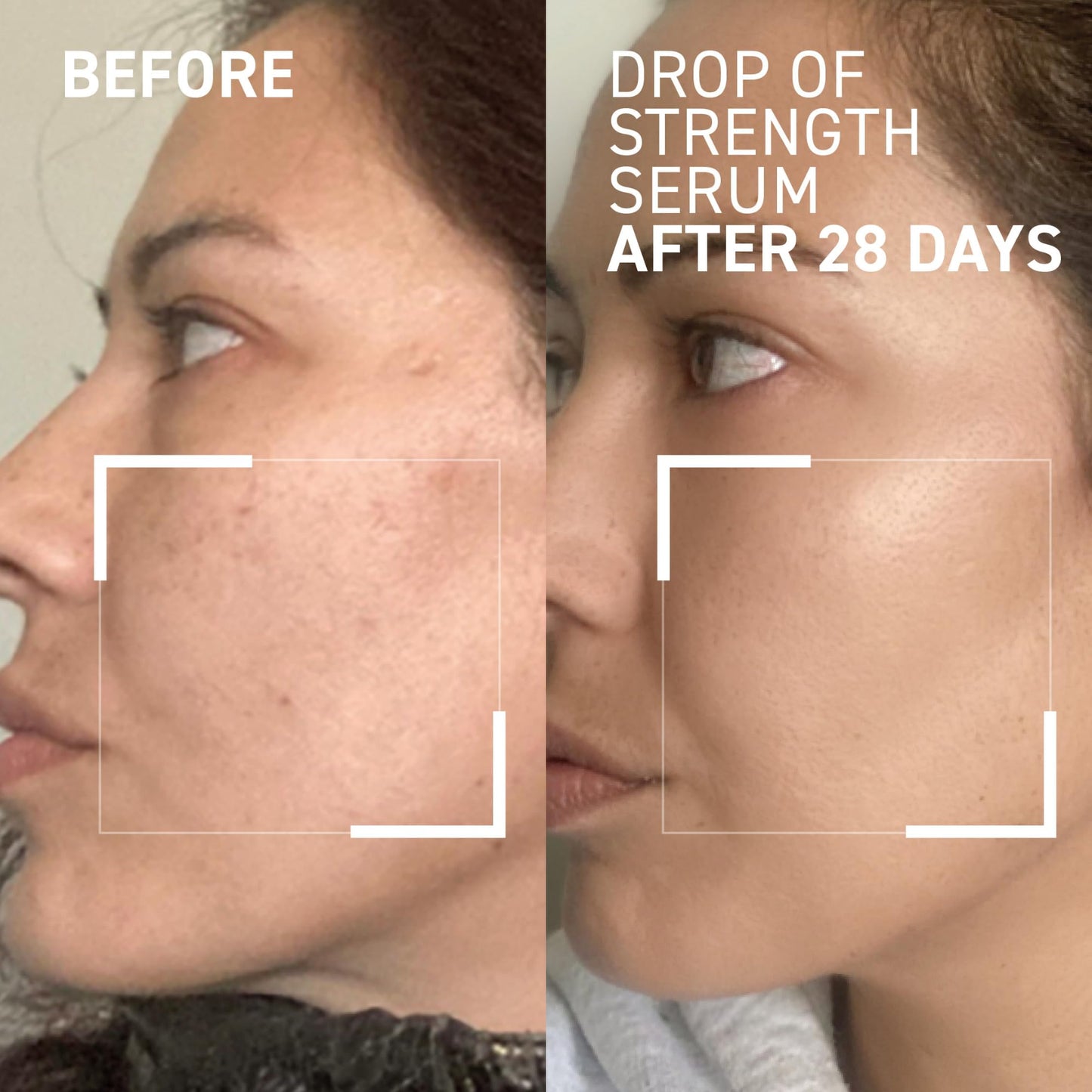 Dr. Brandt Drop of Strength All-Day Strengthening Serum - Enhances Skin Resilience & Provides Instant Hydration - 1.0 fl oz Beauty & Personal Care Dr. Brandt Skincare