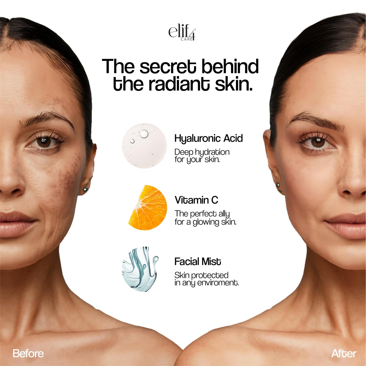 Elif4 care Vitamin C (THD) Serum - Brightening & Antioxidant Face Serum - Vitamin C + Vitamin A&E Evens Skin Tone, Radiance Booster - 30 ml - Vegan Beauty & Personal Care ELIF4 CARE