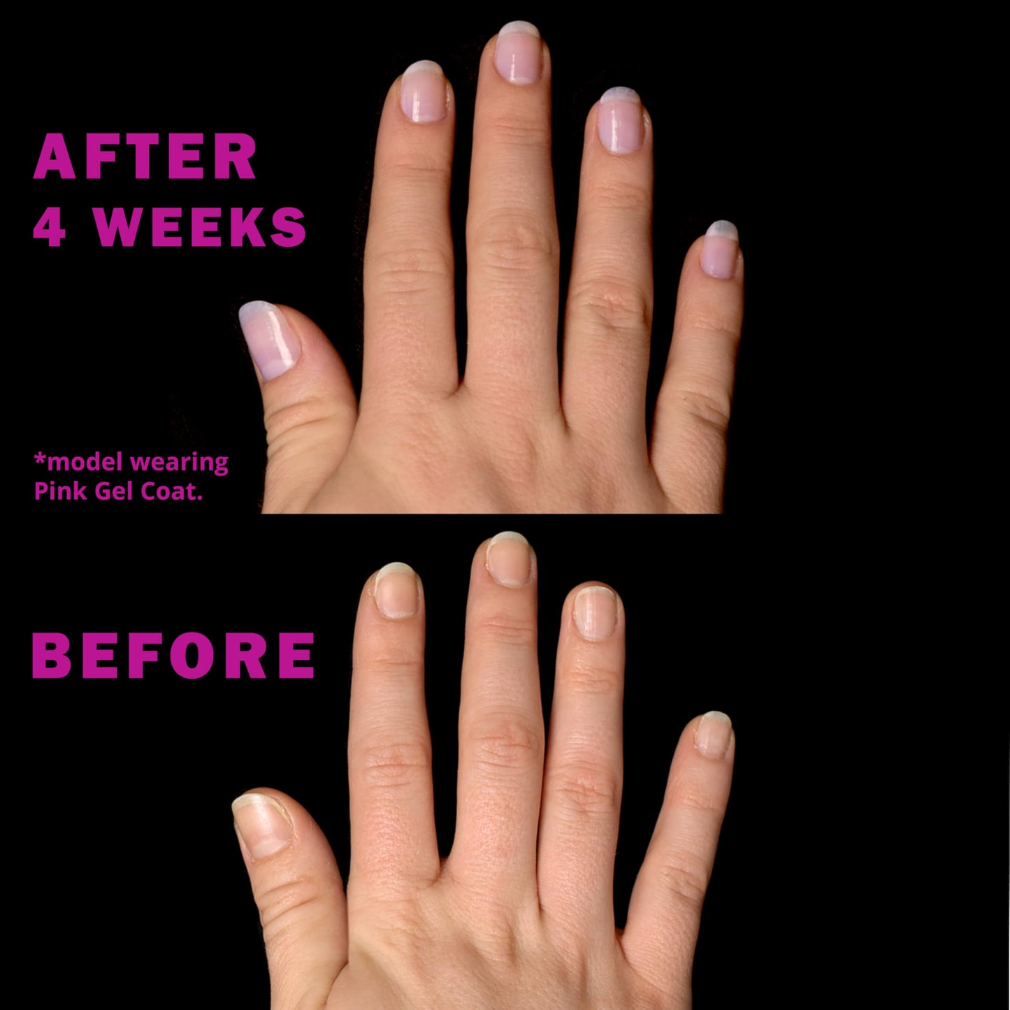 Perfect Formula Ruby Pink Gel Coat - Nail Strengthener, Keratin Nail Treatment, Gemstone Pink Gel Nail Polish - Nail Strengthener for Damaged Nails