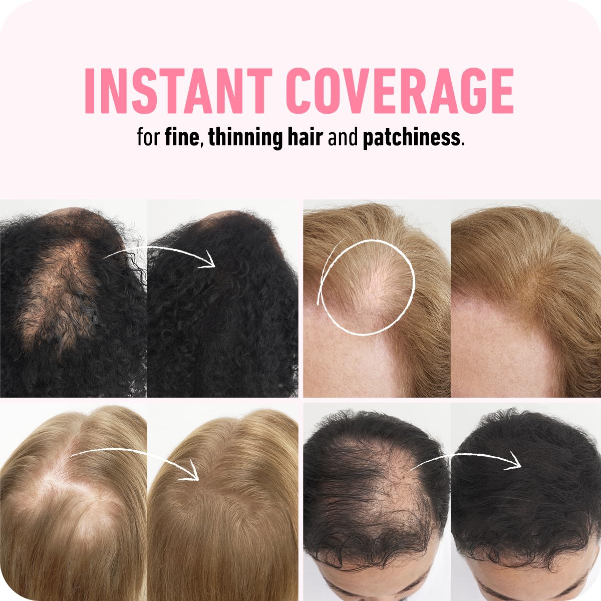 BOLDIFY Hair Fibers - Fill In Thinning and Fine Hair for an Instantly Fuller, Thicker Look - 14 Shades for Women & Men Beauty and Personal Care Boldify