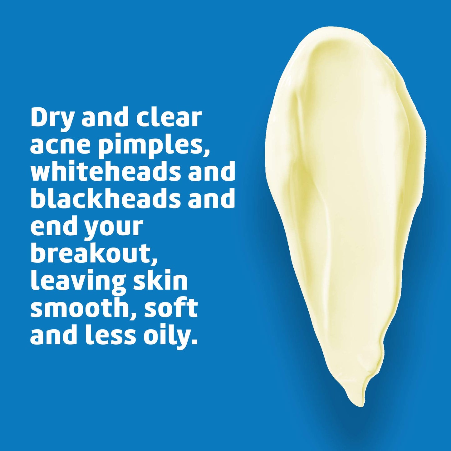 De La Cruz Sulfur Ointment - Cystic Acne Treatment for Face and Body - Daily 10 Min Spot Treatment Mask - Safe and Effective Game Changing Hormonal
