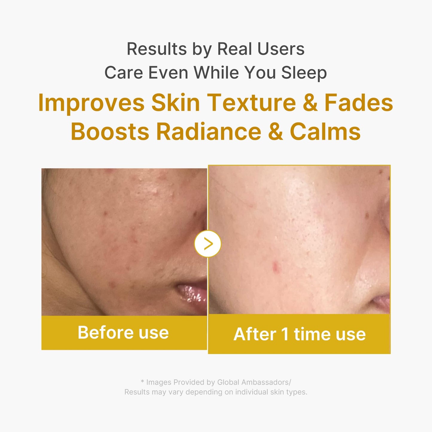 medicube Wrapping Mask Kojic Acid, Turmeric, Vitamin C Overnight Peel Off Facial Mask | Brighten & Defends Against Skin Stress for a Clear, Glowing Beauty and Personal Care medicube