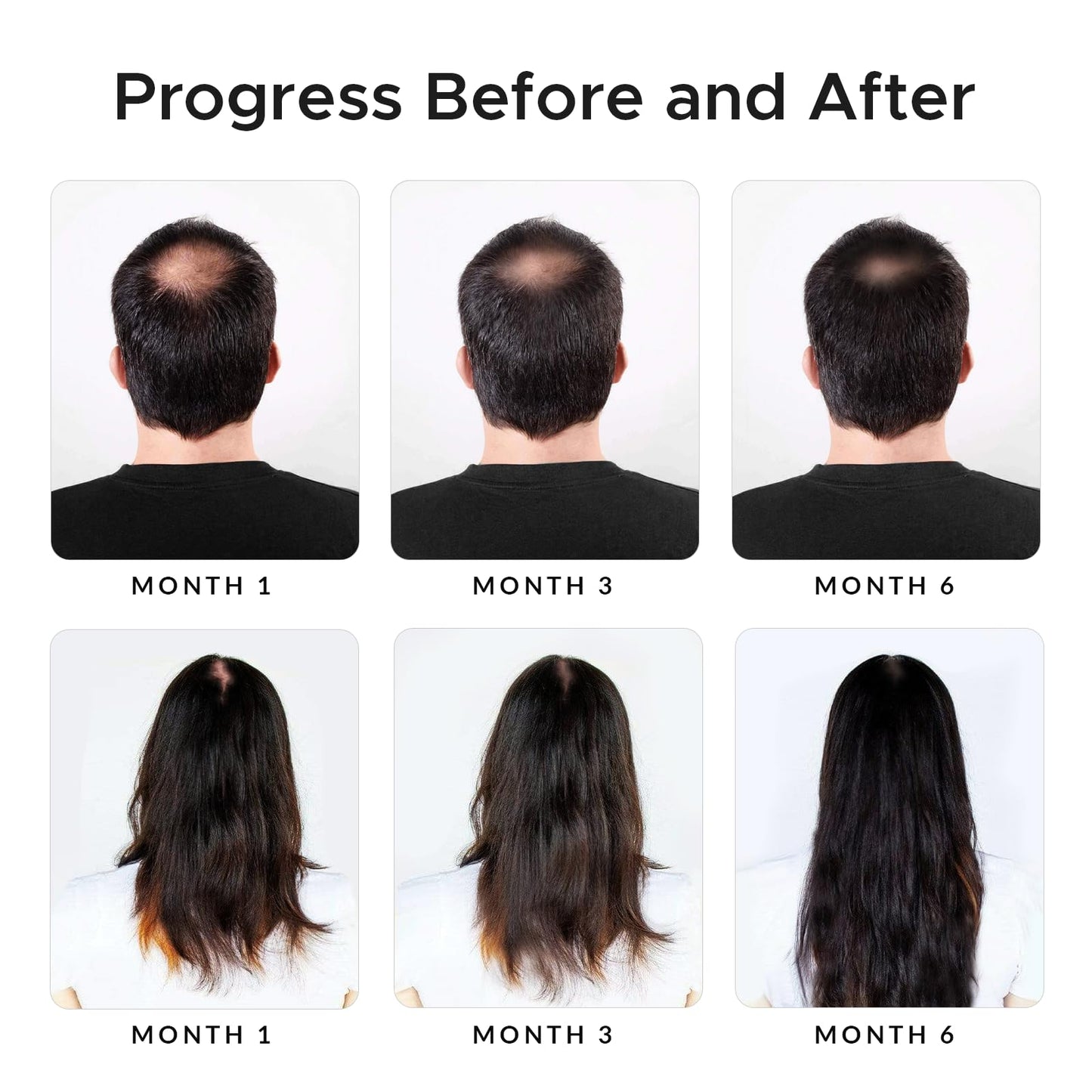 Minoxidil & Biotin Shampoo for Hair Growth - Enriched with Caffeine, Castor Oil & Onion - DHT Blocker for Thicker, Healthier Hair - Strengthening Beauty and Personal Care Growth Essence