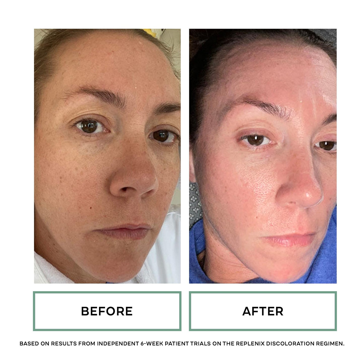 Replenix Glycolic Acid 10% Resurfacing Skin Peel, Medical-Grade Facial Peeling Pads for Discoloration & Acne (60 ct.)