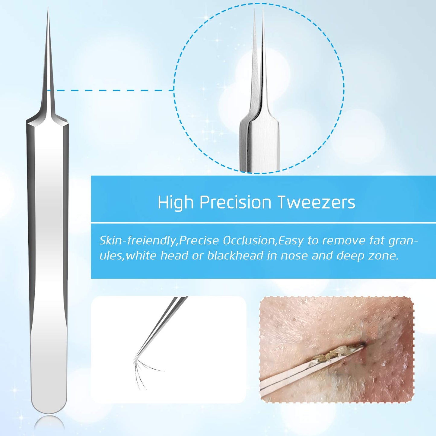 Best Blackhead Remover, Blackheads Blemish Removing, Acne Whitehead Removal Kit, Pimple Comedone Extractor Tool, Popper Pimples Treatment,