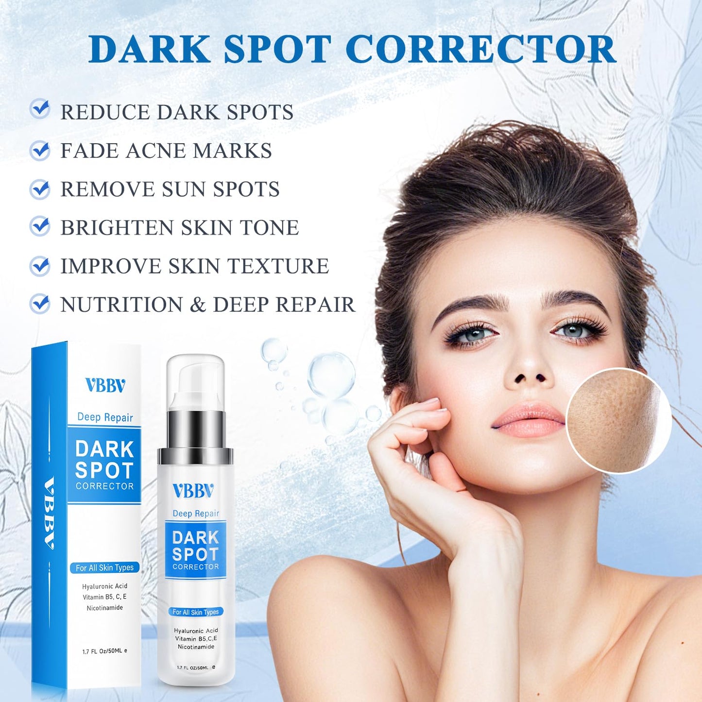 VBBV Dark Spot Remover for Face and Body, Dark Spot Corrector, Sun Spot Freckles Hyperpigmentation Treatment, Advanced Dark Spot Remover Cream