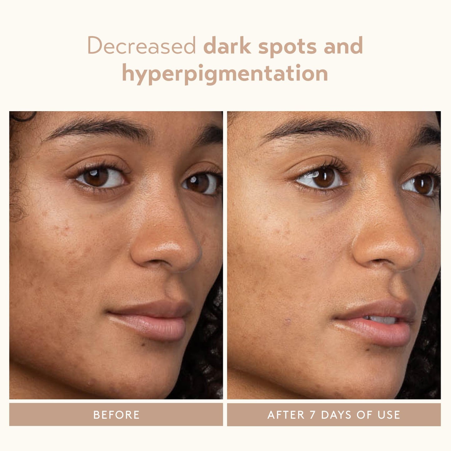 SHANI DARDEN SKIN CARE Lactic Acid Face Serum, Active Night Serum to Help with the Look of Radiant and Smooth Skin, Gentle But Powerful Face