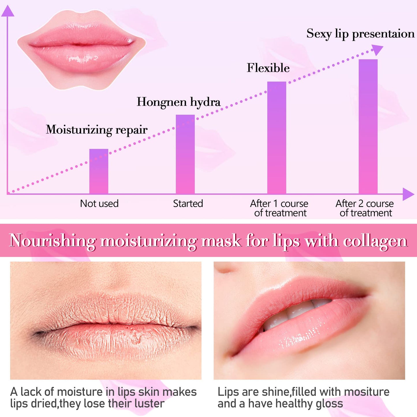 Kipeber 50PCS Lip Mask Sheet,Collagen Crystal Lip Masks,Pink Lip Care Pads Mask for Moisturizing Nourishing,Anti-Aging & Anti-Wrinkle,Lip Gel Patches