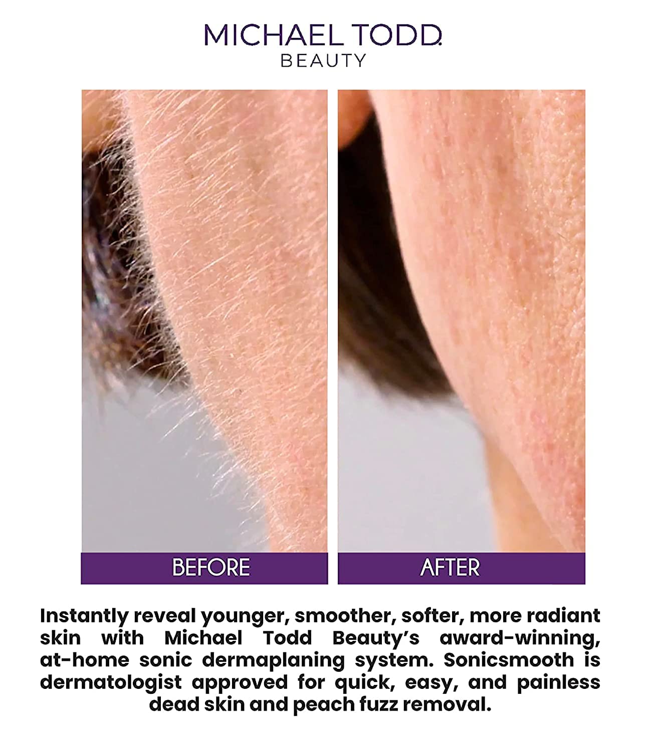 Michael Todd Beauty - Sonicsmooth Pro+ Dermaplaning Blade Refills - 8 Dermaplaning Blades- 2 Month Supply - Device Not Included