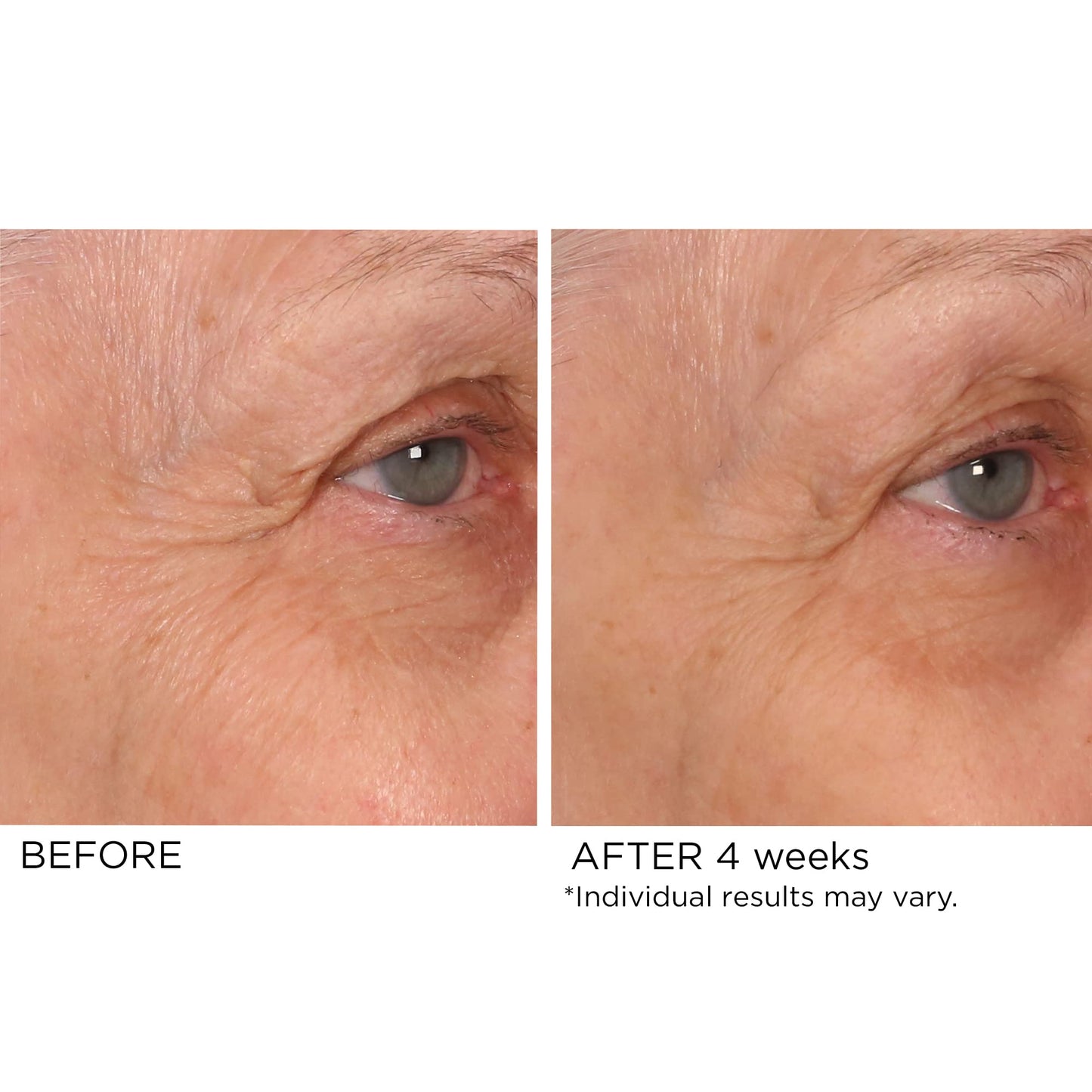 NassifMD Age Defying Eye Renewal Serum - Dual?Action Peptide Brightening for Wrinkles, Puffiness & Dark Circles