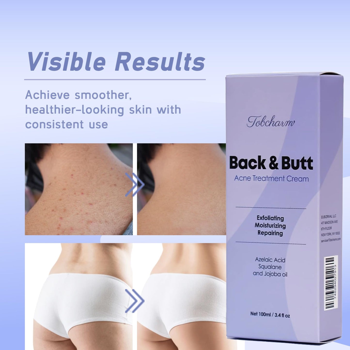 Butt Acne Clearing Treatment, Maximum Strength Body Cream for Back, Buttocks, Thigh & Chest Acne Removal, Skin Clearing Lotion for Men & Women