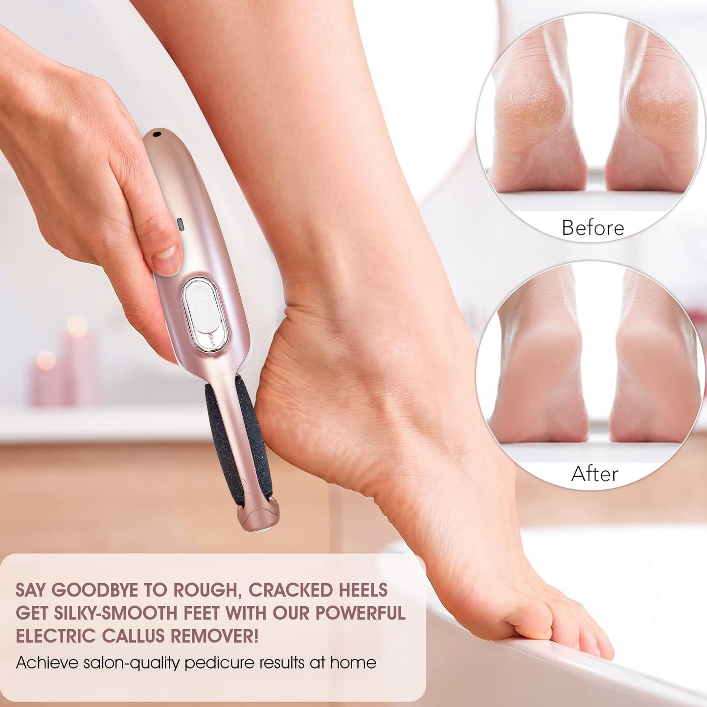 Powerful Electric Callus Remover Wand - Rechargeable Foot File, Grinder & Scrubber - Removes Dead, Hard Skin & Calluses - Best Pedicure Tool for Soft