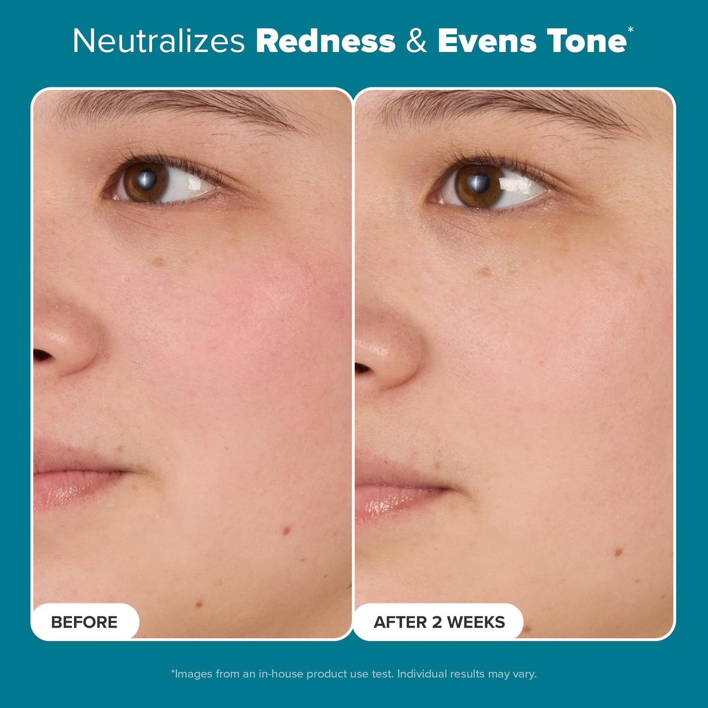 Paula's Choice Skin Balancing Pore-Reducing Face Toner with Niacinamide, for Oily Skin & Combination, Minimizes Large Pores, Controls Oil & Shine
