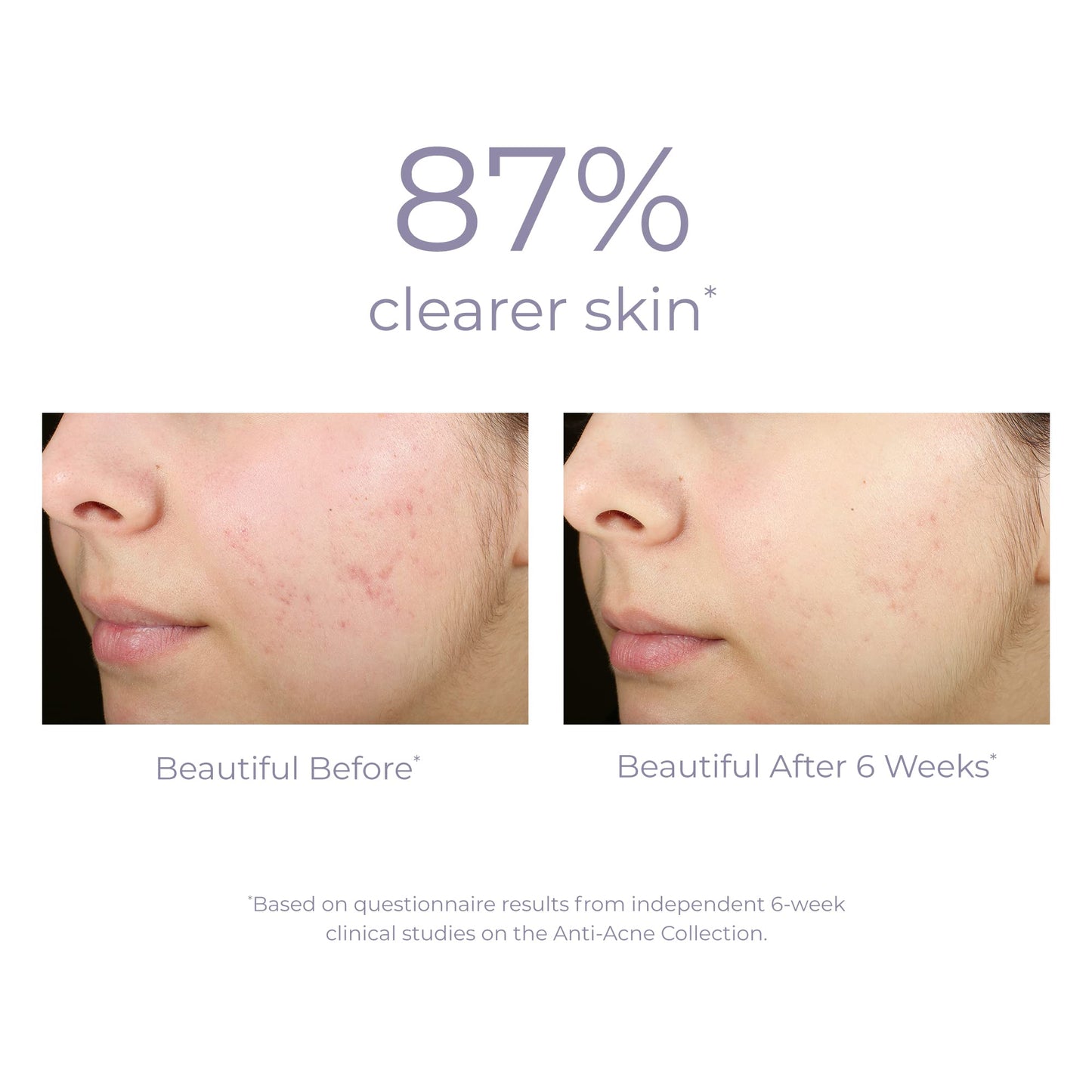 DERMA E Sulfur Spot Treatment - Sulfur and Salicylic Acid Lotion for Breakout-Prone Skin - Soothing Spot Treatment for Face Tones, Balances