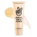 PEACE OUT Acne Gel Cleanser, With 2% Salicylic Acid for Breakouts, Blemishes & Blackheads, Daily Face Wash with Ceramides to Unclog Pores, Support