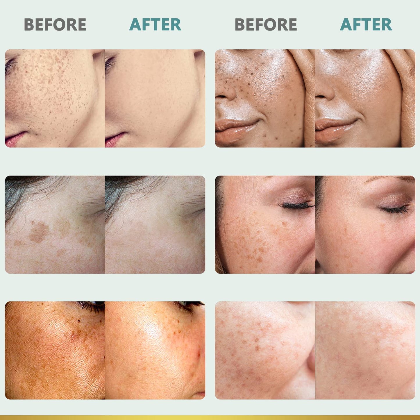 CITYGOO Dark Spot Remover for Face: Dark Spot Corrector Cream - Enriching Skin Care For All Skin Tones - Melasma Freckle Sun Spot Remover & Blemish