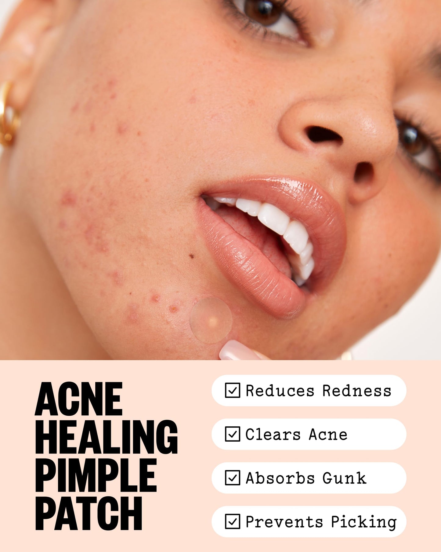 PEACE OUT Acne Healing Dots Hydrocolloid Pimple Patches (40 count) Beauty and Personal Care PEACE OUT
