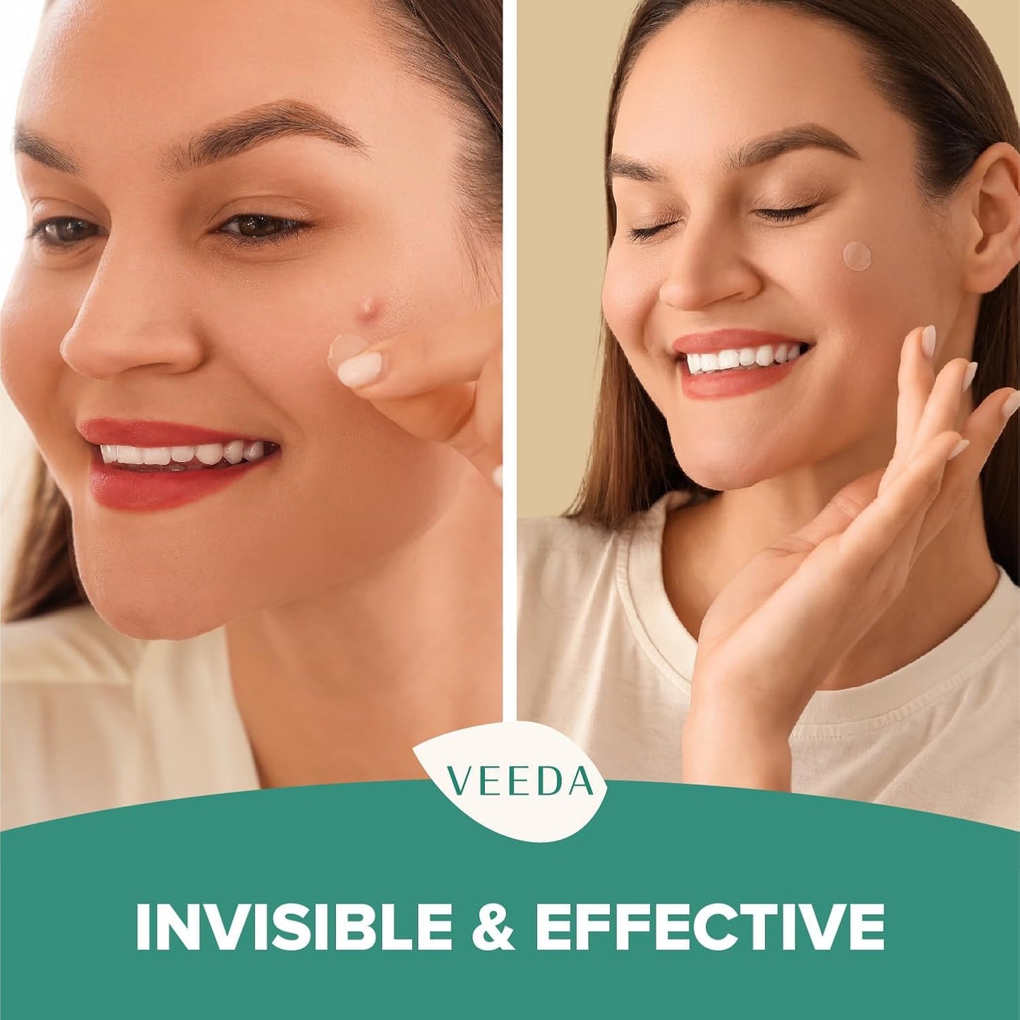 Veeda Glow Pimple Patches - Hydrocolloid Acne Stickers for Fast Healing, Invisible & Non-Irritating Zit Covers, Blemish Spot Treatment, 36 Count