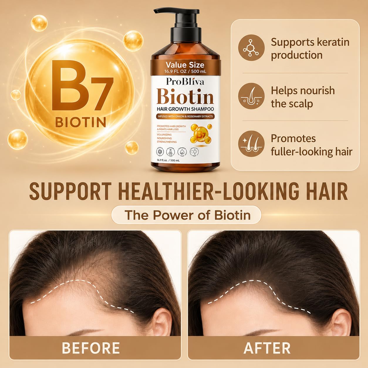 Biotin Hair Growth Shampoo for Thinning Hair in Adults 30+ - Strengthening Formula with Biotin & Rosemary - Reduces Shedding, Supports Fuller