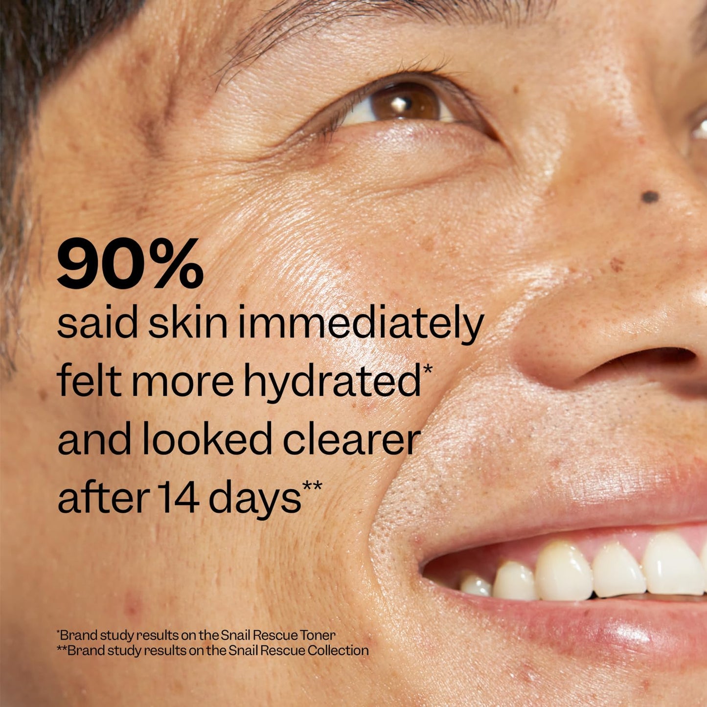 Peach Slices Snail Rescue Toner 4.05 oz – 95% Snail Mucin, CICA & Hyaluronic Acid | Hydrating, Pore-Clearing, Non-Comedogenic, Cruelty-Free K-Beauty