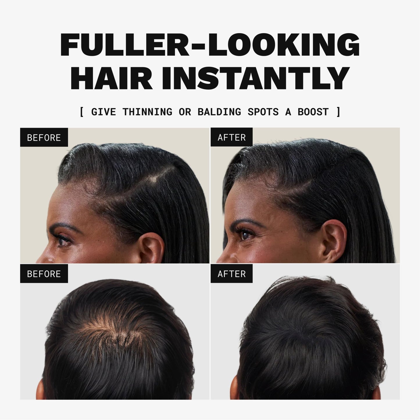 Toppik Hair Building Fibers, Dark Brown, 12g Fill In Fine or Thinning Hair, Instantly Thicker, Fuller Looking, 9 Shades for Men & Women, Keratin Beauty and Personal Care TOPPIK