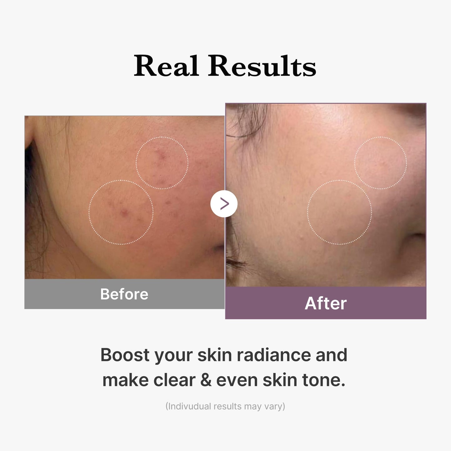 medicube Age-R Glutathione Glow Milky Toner Beauty and Personal Care medicube