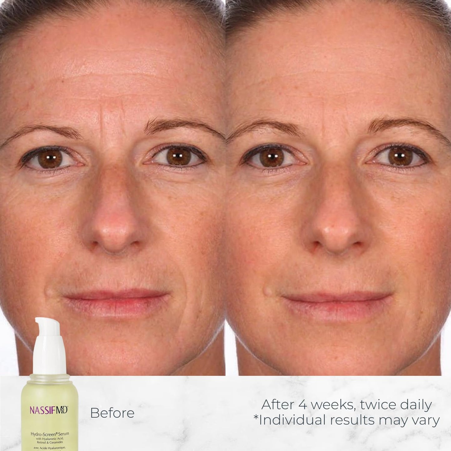 NassifMD Hydro-Screen Hydration Serum | Surgeon-Created Hyaluronic Acid, Ceramides & Retinol Formula for Plumping, Firming & Reducing Fine Lines