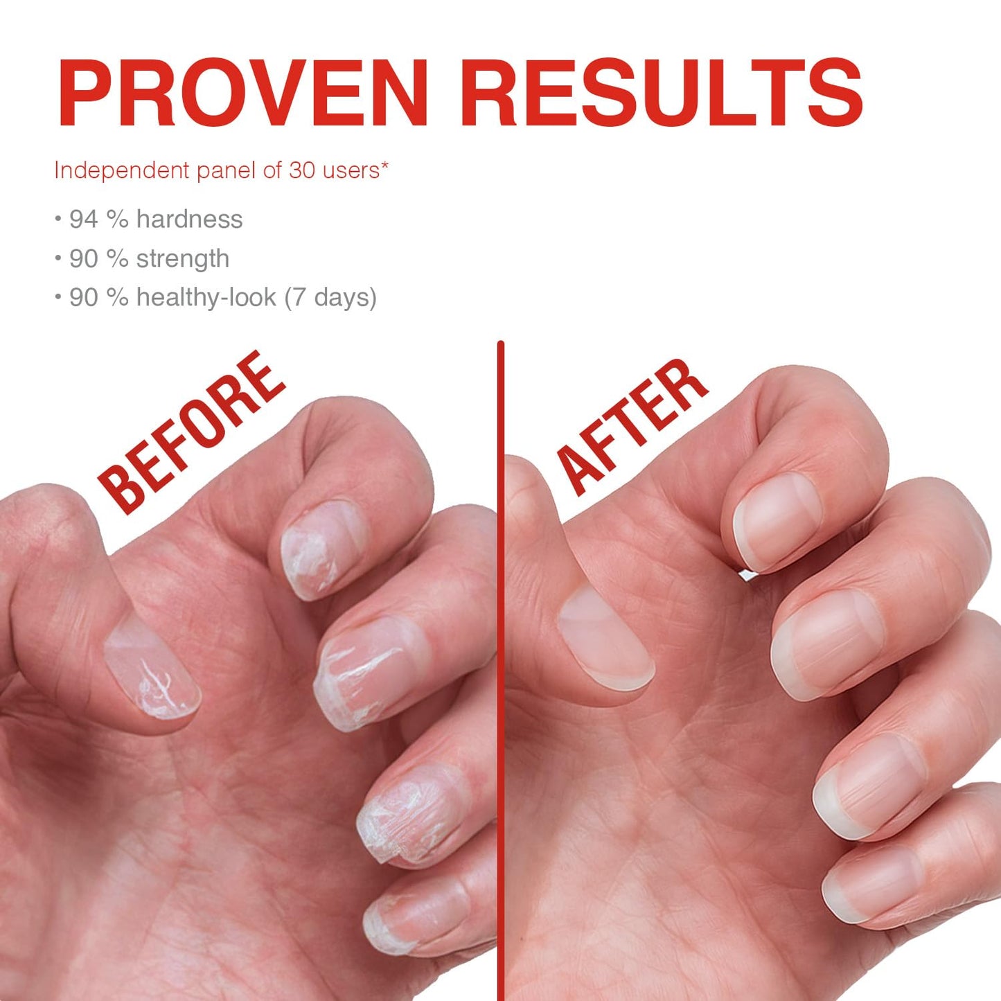 Probelle Nail Strengthener and growth, Natural Nail Strengthening Clear Nail Polish Repair Treatment, Nail Growth & Conditioning, Stops Splits, Chips