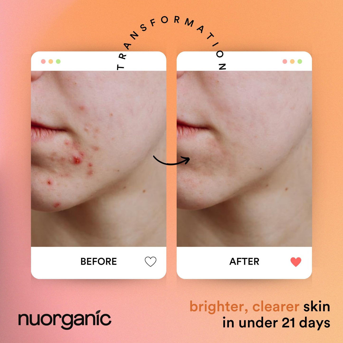 nuorganic Turmeric Face Mask - Soothing, Acne Clearing, Pore Refining, Exfoliating - New Airtight Squeezy Tube, Stays Fresh for 12 Months - Clean