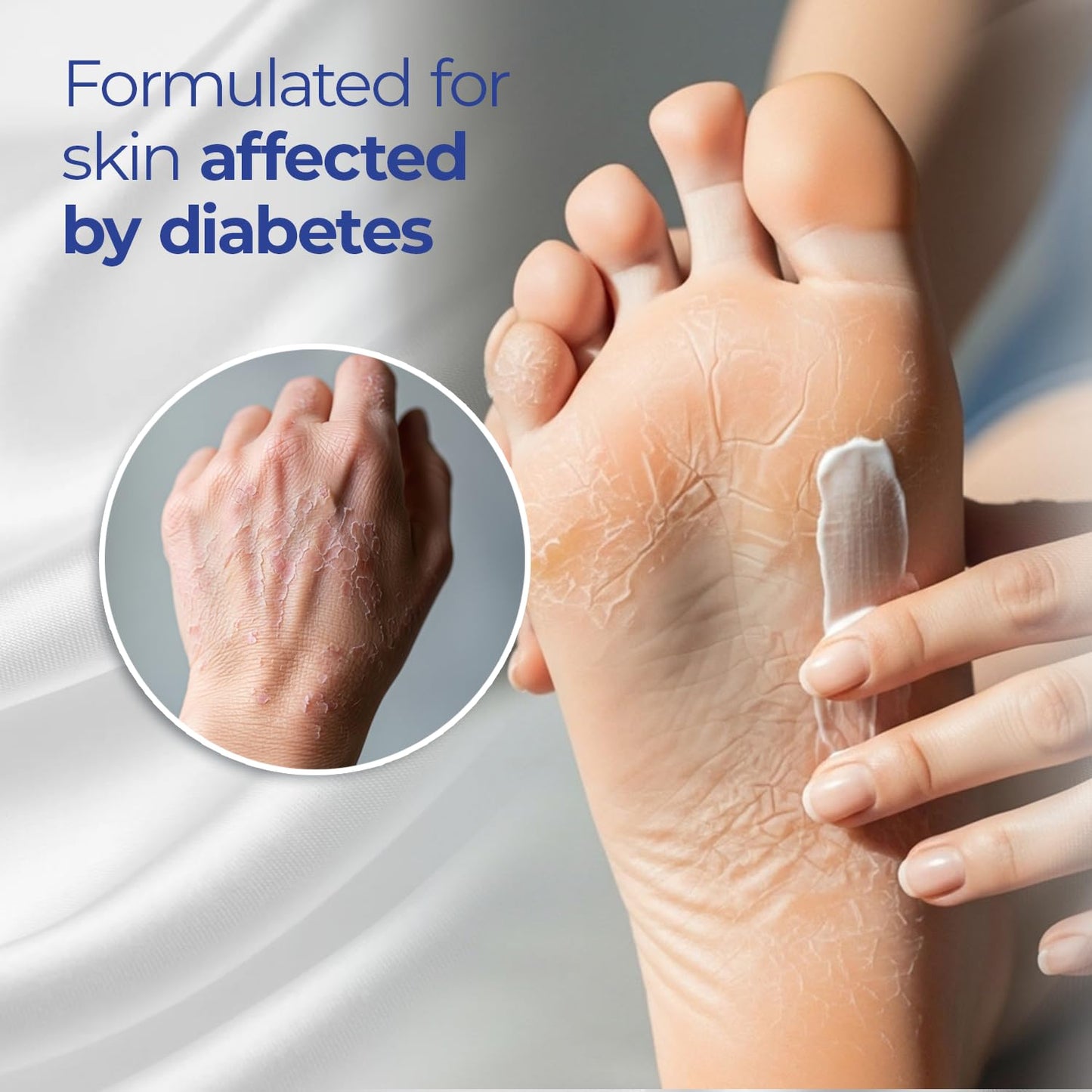 Goicoechea Diabet TX Diabetic Lotion with Urea for Dry Skin | Soothing Hydrating Cream with Aloe, Oatmeal & Vitamin E for Hands, Elbows, Feet & Body |
