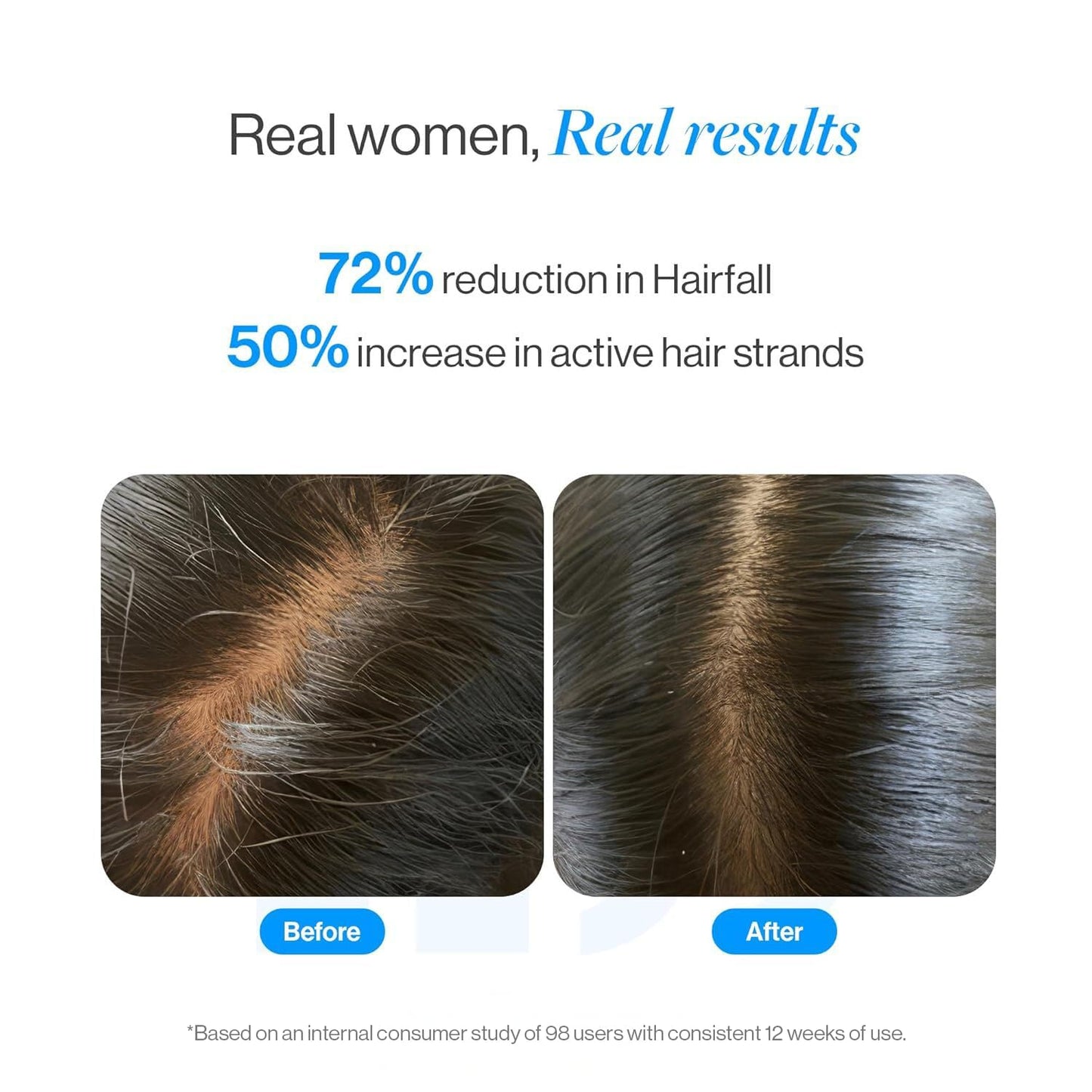 Be Bodywise Rosemary Hair Growth Serum Roll On 10 ml - 3% Rosemary, 3% Redensyl & 2% Anagain | DHT-Blocking Scalp Serum Boosts Oxygen Flow, Reduces Beauty and Personal Care Be Bodywise