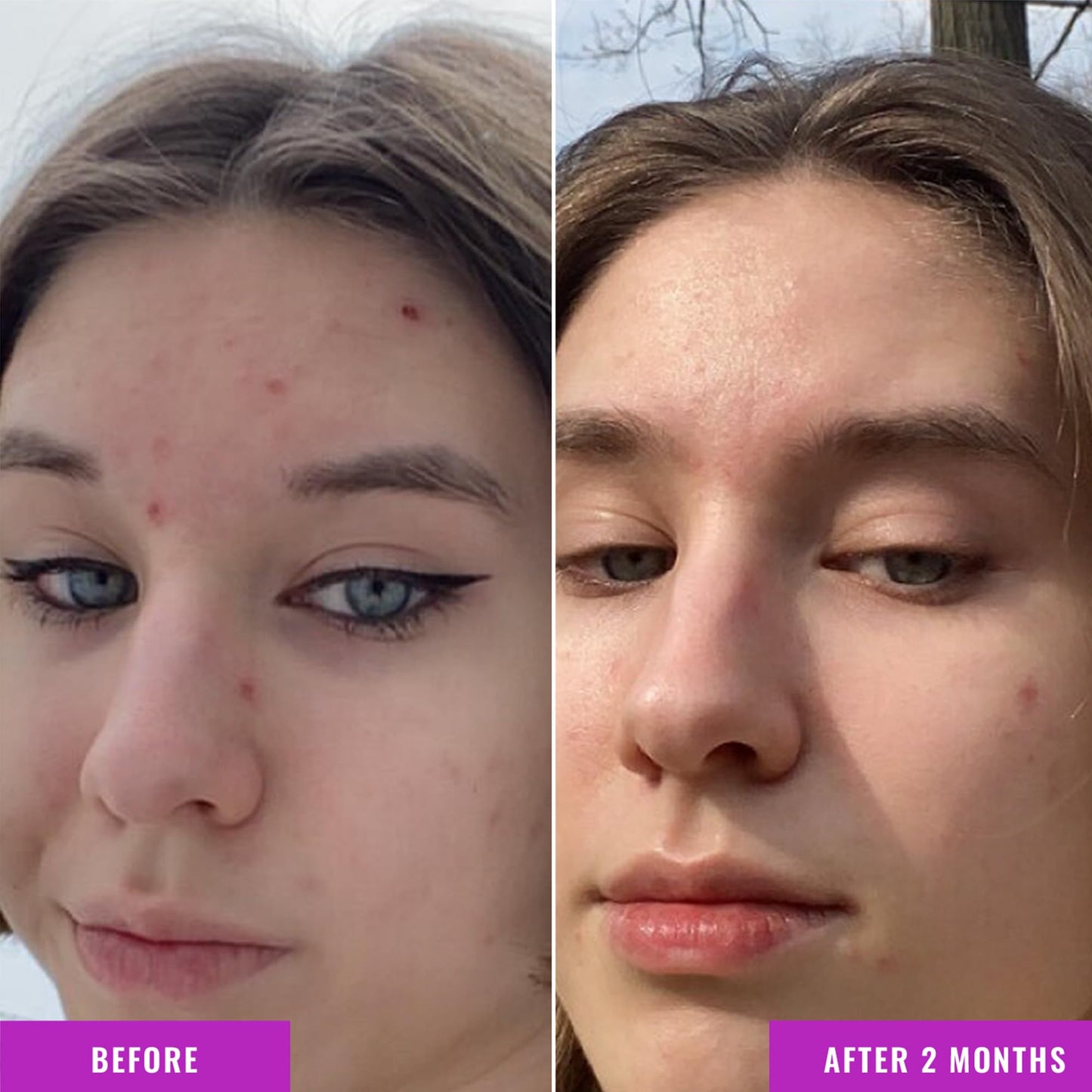 Good Molecules Niacinamide Serum - 10% Niacinamide to Target Blemishes, Nourishment, and Skin Tone - Ultra Hydrating Serum and Brightening Skin Care