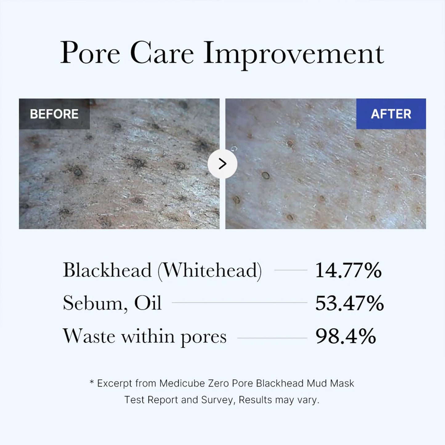 medicube Zero Pore Blackhead Mud Facial Mask - Skin Cooling & Pore Tightening - 3 Minute Quick Dry Formula with AHA, BHA, PHA, and Pore-Purifying Clay Beauty and Personal Care medicube