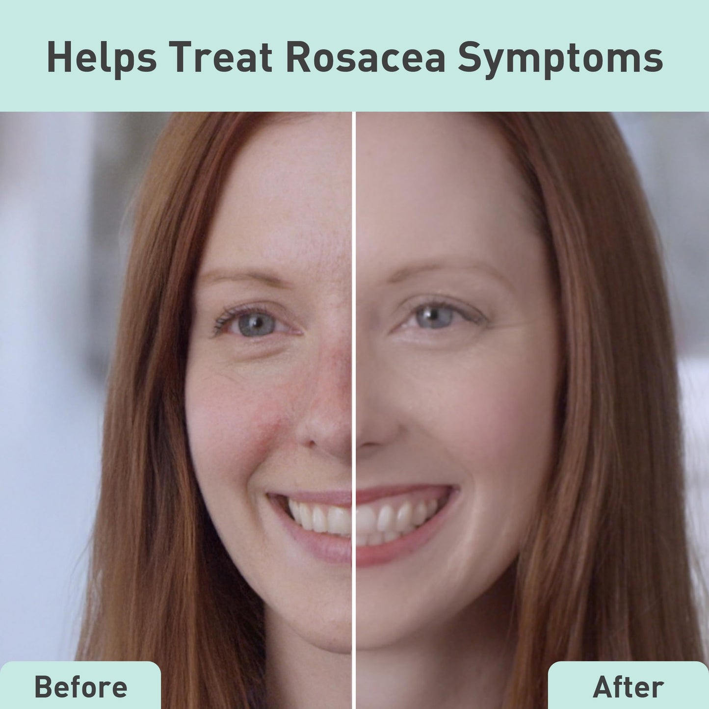 Procure Rosacare Serum 1.08 fl oz